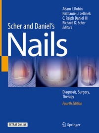 Abbildung von: Scher and Daniel's Nails - Springer