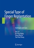Abbildung von: Special Type of Finger Replantation - Springer