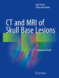 Abbildung von: CT and MRI of Skull Base Lesions - Springer