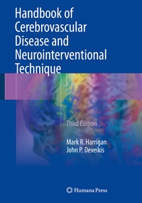 Abbildung von: Handbook of Cerebrovascular Disease and Neurointerventional Technique - Humana