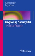 Cover: Ankylosing Spondylitis - Springer