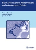 Cover: Brain Arteriovenous Malformations and Arteriovenous Fistulas - Thieme Publishers