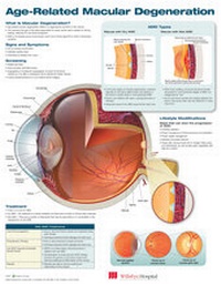 Abbildung von: Age-Related Macular Degeneration Anatomical Chart - Lippincott Williams and Wilkins