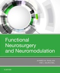 Bild: Functional Neurosurgery and Neuromodulation - Elsevier