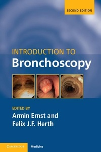 Enlarge image Cover: Introduction to Bronchoscopy - Cambridge University Press