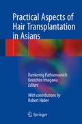 Cover: Practical Aspects of Hair Transplantation in Asians - Springer
