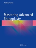 Cover: Mastering Advanced Rhinoplasty - Springer