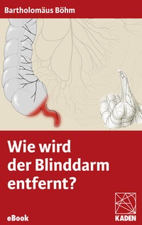 Enlarge image Cover: Wie wird der Blinddarm entfernt? - Kaden, R