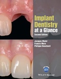 Cover: Implant Dentistry at a Glance - Wiley