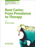 Cover: Root Caries: From Prevalence to Therapy - S. Karger