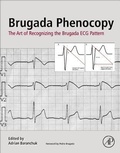 Cover: Brugada Phenocopy - Academic Press