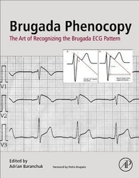 Enlarge image Cover: Brugada Phenocopy - Academic Press