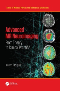 Abbildung von: Advanced MR Neuroimaging - CRC Press