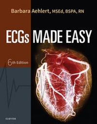 Abbildung von: ECGs Made Easy - E-Book - Mosby