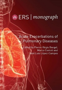 Abbildung von: Acute Exacerbations of Pulmonary Diseases - European Respiratory Society
