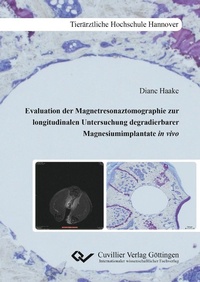 Bild: Evaluation der Magnetresonaztomographie zur longitudinalen Untersuchung degradierbarer Mag-nesiumimplantate in vivo - Cuvillier Verlag