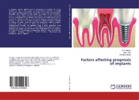 Abbildung von: Factors affecting prognosis of implants - LAP Lambert Academic Publishing