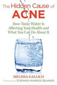 Abbildung von: The Hidden Cause of Acne - Simon + Schuster Inc.