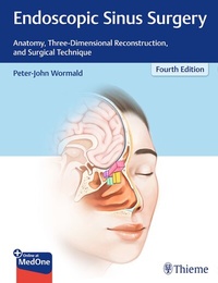 Abbildung von: Endoscopic Sinus Surgery - Thieme Publishers