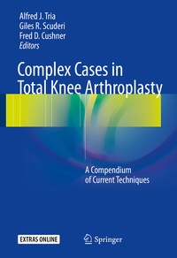 Abbildung von: Complex Cases in Total Knee Arthroplasty - Springer