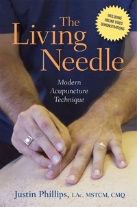 Abbildung von: The Living Needle - Singing Dragon