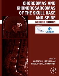 Bild: Chordomas and Chondrosarcomas of the Skull Base and Spine - Academic Press