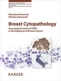 Abbildung von: Breast Cytopathology - S. Karger
