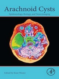 Abbildung von: Arachnoid Cysts - Academic Press