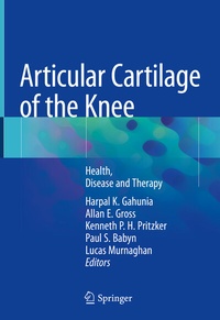 Abbildung von: Articular Cartilage of the Knee - Springer