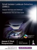 Cover: Small Incision Lenticule Extraction (SMILE): Surgical Technique and Challenges - Jaypee Brothers Medical Publishers