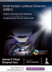 Enlarge image Cover: Small Incision Lenticule Extraction (SMILE): Surgical Technique and Challenges - Jaypee Brothers Medical Publishers