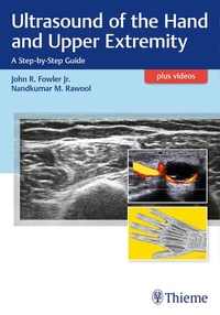 Abbildung von: Ultrasound of the Hand and Upper Extremity - Thieme Publishers