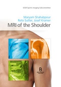 Cover: MRI of the Shoulder - Breitenseher Publisher