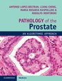 Cover: Pathology of the Prostate - Cambridge University Press
