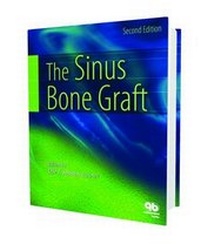 Abbildung von: Sinus Bone Graft - Quintessence Publishing Co Inc.,U.S.
