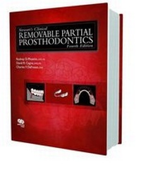 Abbildung von: Stewart's Clinical Removal Partial Prosthodontics - Quintessence Publishing Co Inc.,U.S.