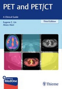 Enlarge image Cover: PET and PET/CT - Thieme Publishers