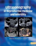 Cover: Ultrasonography in Reproductive Medicine and Infertility - Cambridge University Press