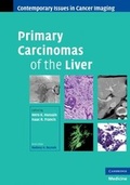 Cover: Primary Carcinomas of the Liver - Cambridge University Press