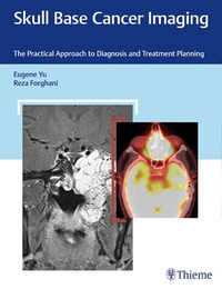 Enlarge image Cover: Skull Base Cancer Imaging - Thieme Publishers
