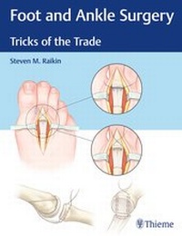 Abbildung von: Foot and Ankle Surgery - Thieme Publishers