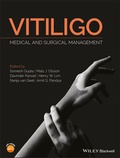 Cover: Vitiligo - Wiley