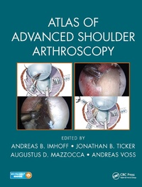 Abbildung von: Atlas of Advanced Shoulder Arthroscopy - CRC Press