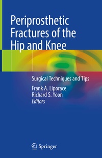 Abbildung von: Periprosthetic Fractures of the Hip and Knee - Springer