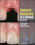 Cover: Implant Dentistry at a Glance - Wiley