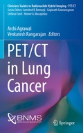 Cover: PET/CT in Lung Cancer - Springer