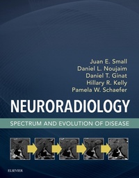 Bild: Neuroradiology - Elsevier