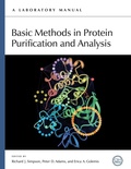 Bild: Basic Methods in Protein Purification and Analysis - Cold Spring Harbor Laboratory Press,U.S.