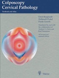 Cover: Colposcopy Cervical Pathology - Thieme
