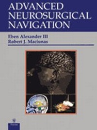 Enlarge image Cover: Advanced Neurosurgical Navigation - Thieme Publishers